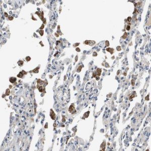 Anti-SLC25A20 antibody produced in rabbit 