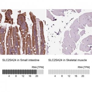 Anti-SLC25A24 antibody produced in rabbit 