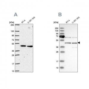 Anti-SLC25A24 antibody produced in rabbit 