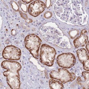 Anti-SLC25A42 antibody produced in rabbit 