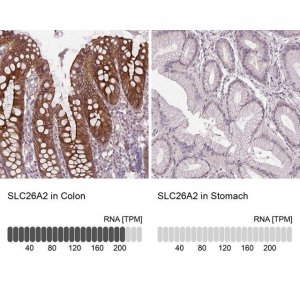 Anti-SLC26A2 antibody produced in rabbit 
