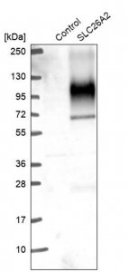Anti-SLC26A2 antibody produced in rabbit 