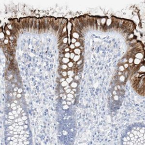 Anti-SLC26A3 antibody produced in rabbit 