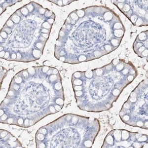 Anti-SLC26A3 antibody produced in rabbit 