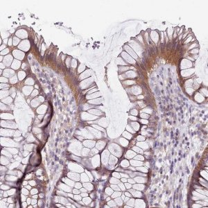 Anti-SLC26A6 antibody produced in rabbit 