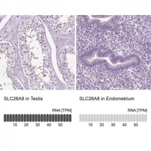 Anti-SLC26A8 antibody produced in rabbit 