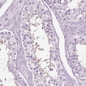 Anti-SLC26A8 antibody produced in rabbit 
