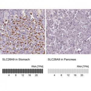 Anti-SLC26A9 antibody produced in rabbit 