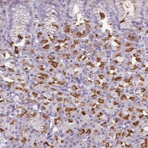 Anti-SLC26A9 antibody produced in rabbit 