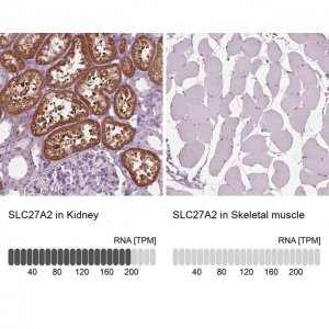 Anti-SLC27A2 antibody produced in rabbit 
