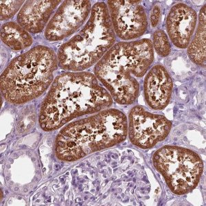 Anti-SLC27A2 antibody produced in rabbit 