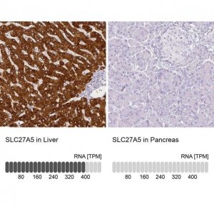 Anti-SLC27A5 antibody produced in rabbit 