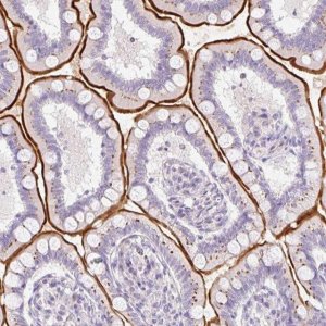 Anti-SLC28A1 antibody produced in rabbit 
