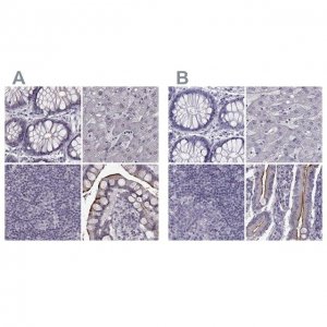 Anti-SLC28A2 antibody produced in rabbit 