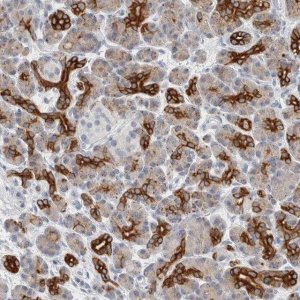 Anti-SLC28A3 antibody produced in rabbit 