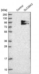 Anti-SLC28A3 antibody produced in rabbit 