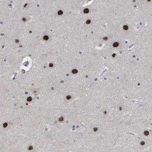 Anti-SLC29A2 antibody produced in rabbit 