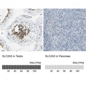 Anti-SLC2A5 antibody produced in rabbit 
