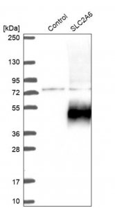 Anti-SLC2A6 antibody produced in rabbit 