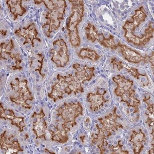 Anti-SLC2A6 antibody produced in rabbit 