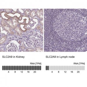 Anti-SLC2A9 antibody produced in rabbit 