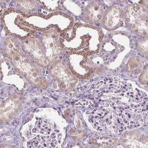 Anti-SLC2A9 antibody produced in rabbit 