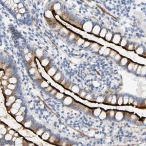 Anti-SLC30A7 antibody produced in rabbit 