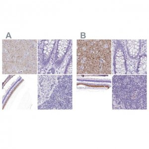 Anti-SLC32A1 antibody produced in rabbit 