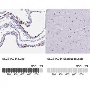 Anti-SLC34A2 antibody produced in rabbit 