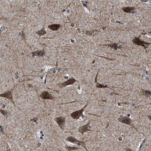 Anti-SLC35F1 antibody produced in rabbit 