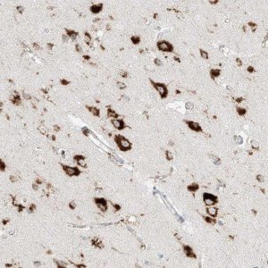 Anti-SLC35F6 antibody produced in rabbit 