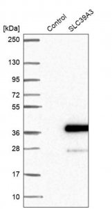 Anti-SLC39A3 antibody produced in rabbit 