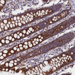 Anti-SLC39A3 antibody produced in rabbit 