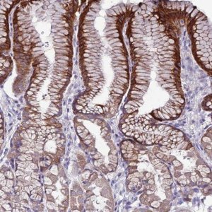 Anti-SLC44A3 antibody produced in rabbit 