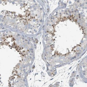 Anti-SLC44A5 antibody produced in rabbit 