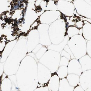Anti-SLC4A1 antibody produced in rabbit 