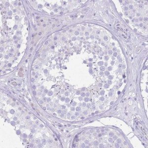 Anti-SLC4A4 antibody produced in rabbit 