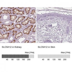 Anti-SLC5A12 antibody produced in rabbit 