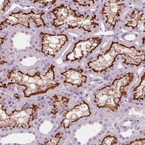 Anti-SLC5A12 antibody produced in rabbit 