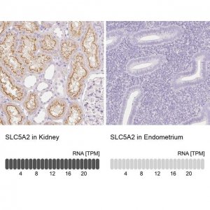 Anti-SLC5A2 antibody produced in rabbit 