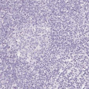 Anti-SLC5A2 antibody produced in rabbit 