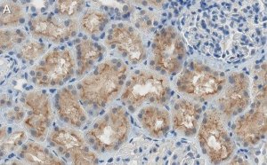 Anti-SLC5A2 Antibody, clone 2I4 ZooMAb Rabbit Monoclonal 
