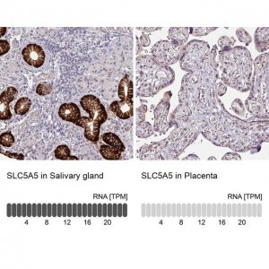 Anti-SLC5A5 antibody produced in rabbit 
