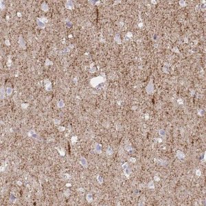Anti-SLC6A1 antibody produced in rabbit 