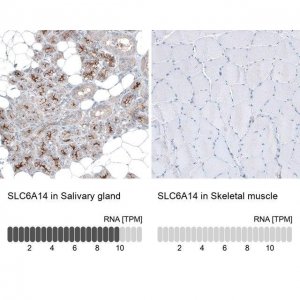 Anti-SLC6A14 antibody produced in rabbit 