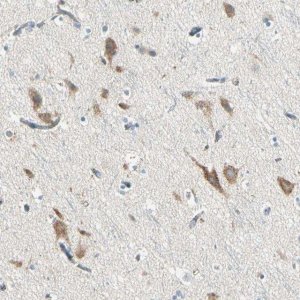 Anti-SLC6A15 antibody produced in rabbit 