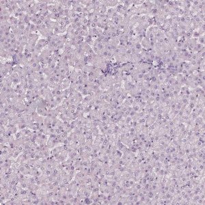 Anti-SLC6A17 antibody produced in rabbit 