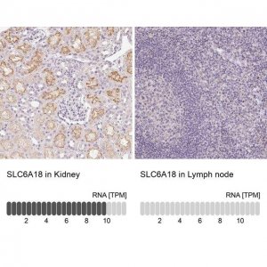 Anti-SLC6A18 antibody produced in rabbit 