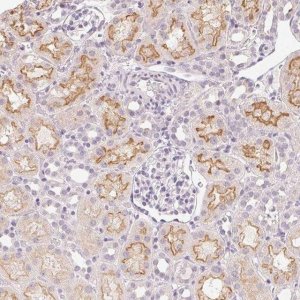 Anti-SLC6A18 antibody produced in rabbit 