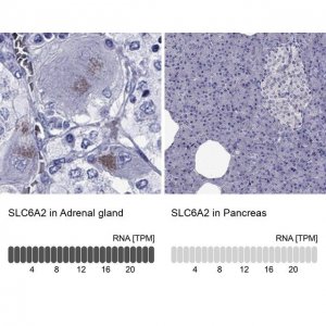 Anti-SLC6A2 